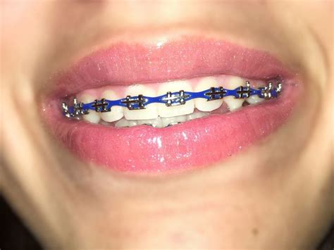 navy blue braces power chain